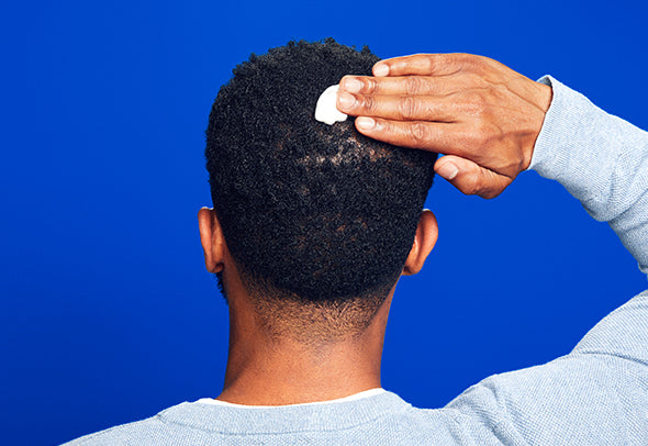 Back of a man’s head while applying men’s Rogaine Foam on a blue background.